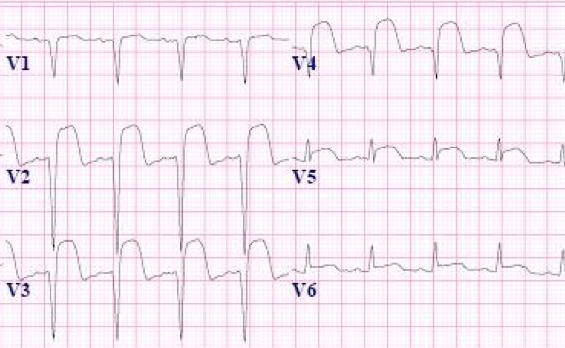 Sythentic ECG image