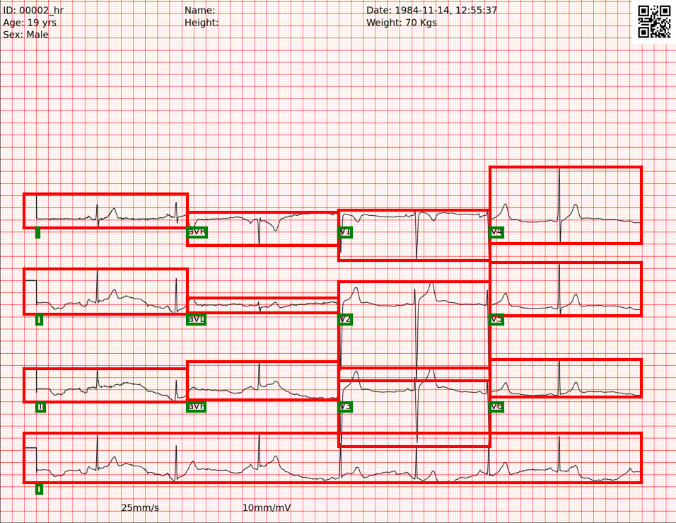 Sythentic ECG image