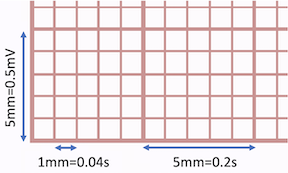 Standard printed ECG grid