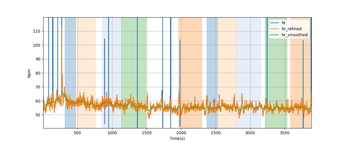 Heart rate - Overlay