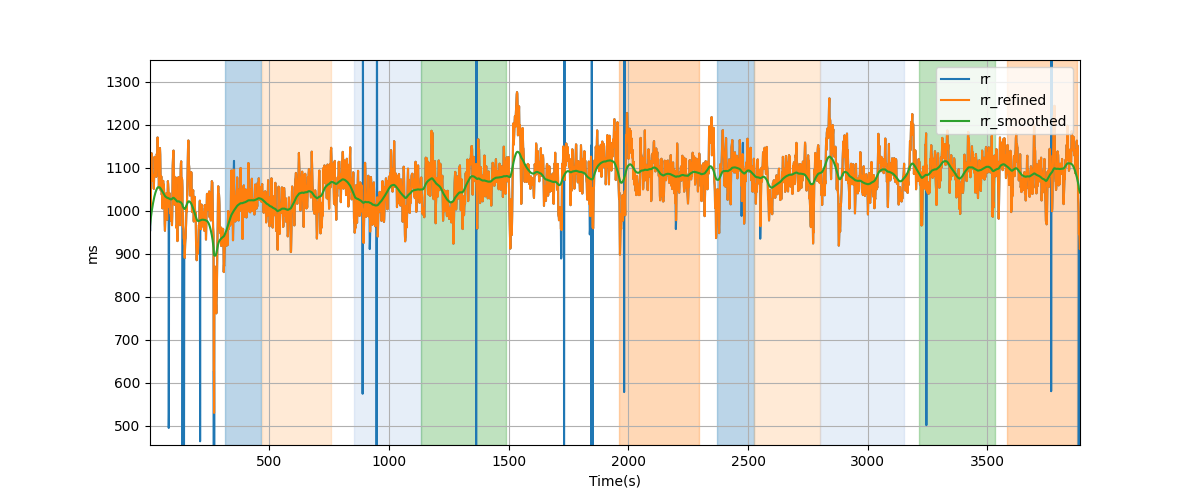 RR intervals - Overlay