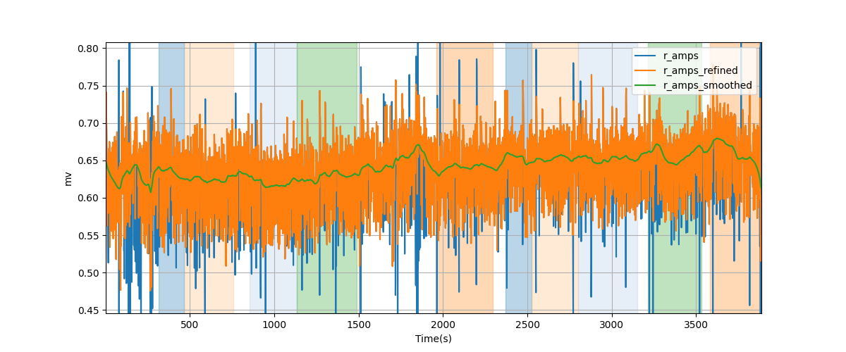 R-wave amplitudes - Overlay