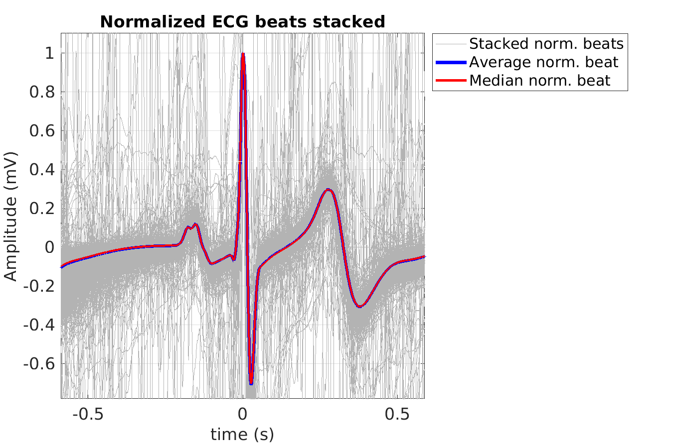 P015_ecg_norm_beats_stacked