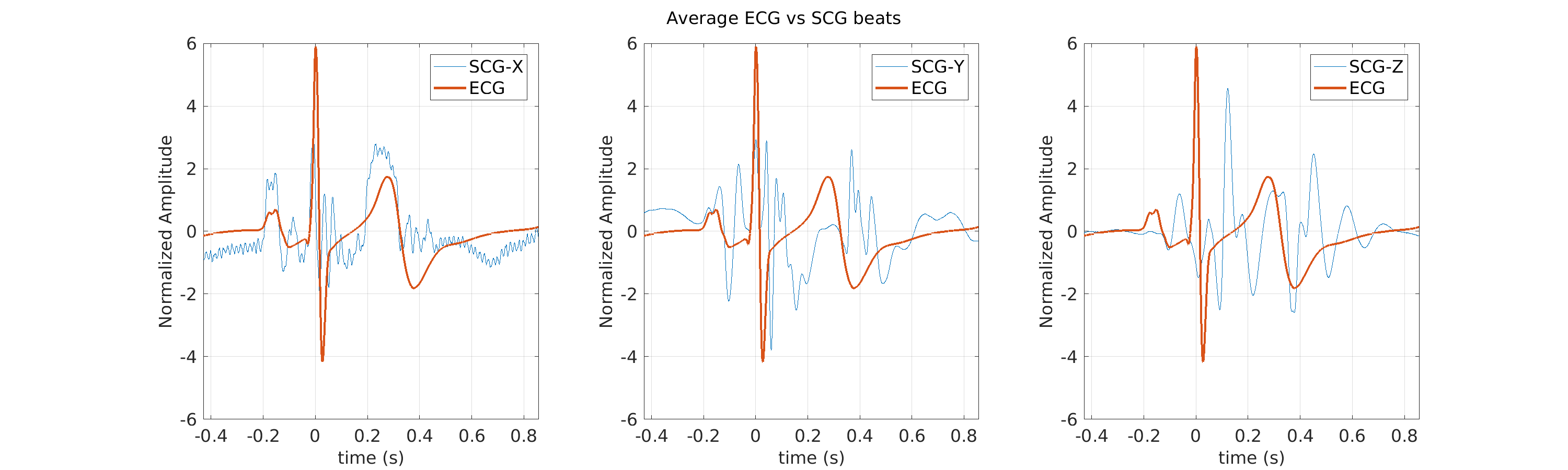 P015_scg_avg_ecg_scg