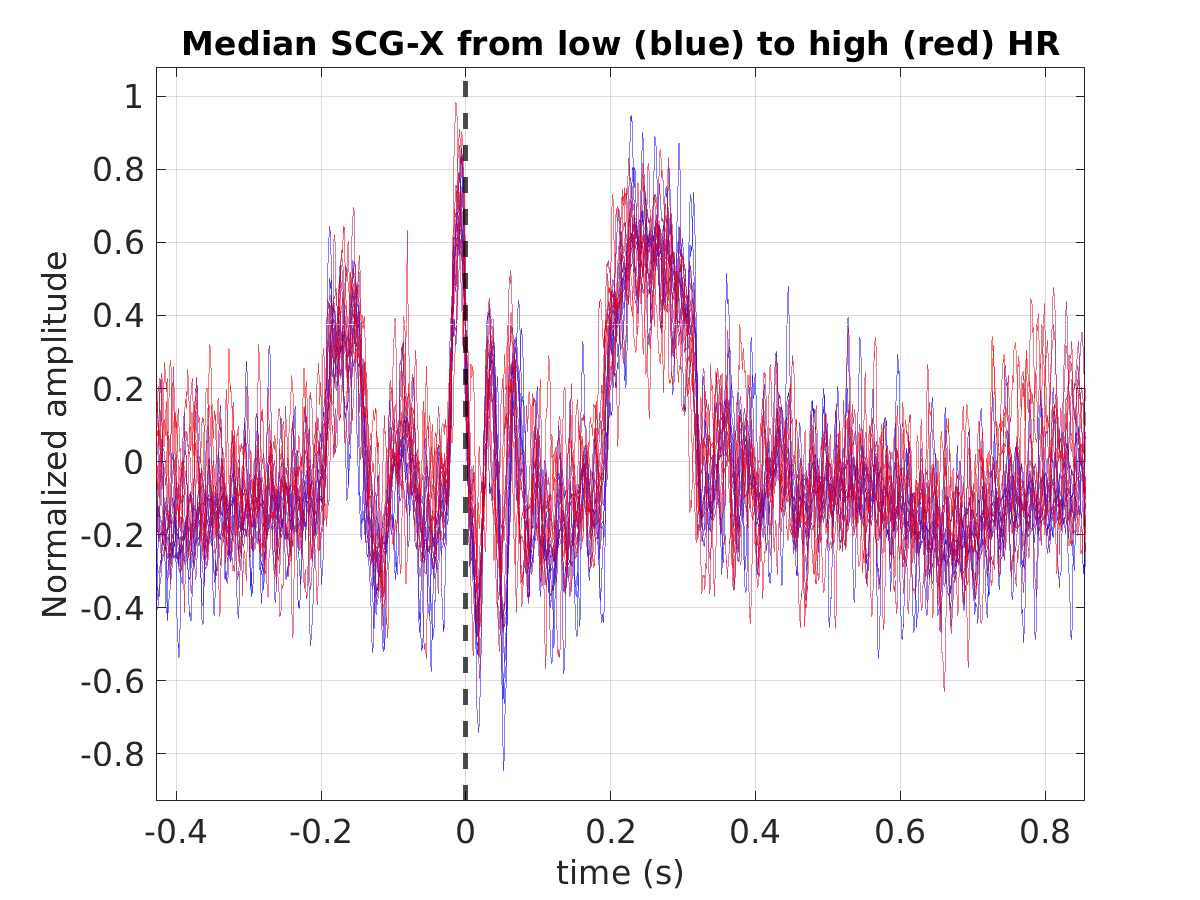 P015_scg_med_scgx_hr_binned_norm