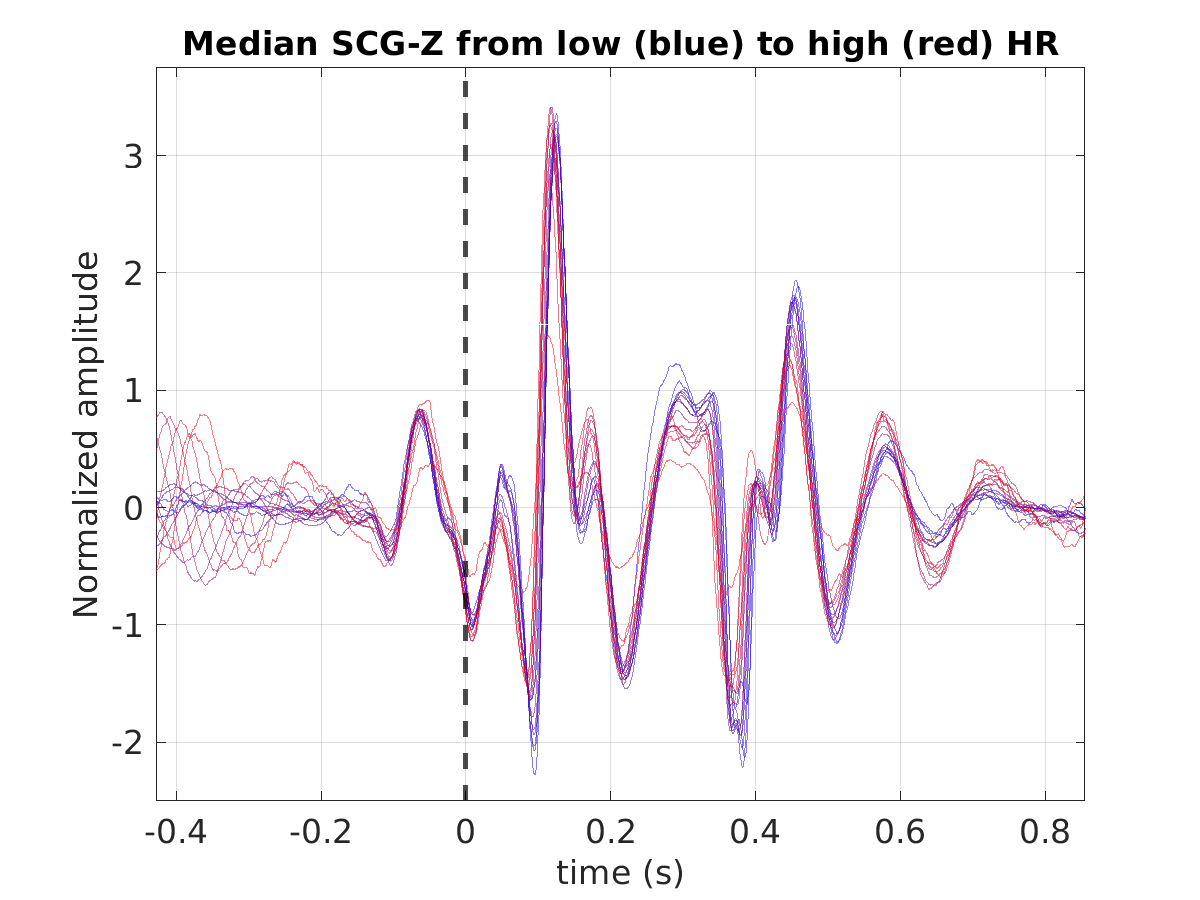 P015_scg_med_scgz_hr_binned_norm