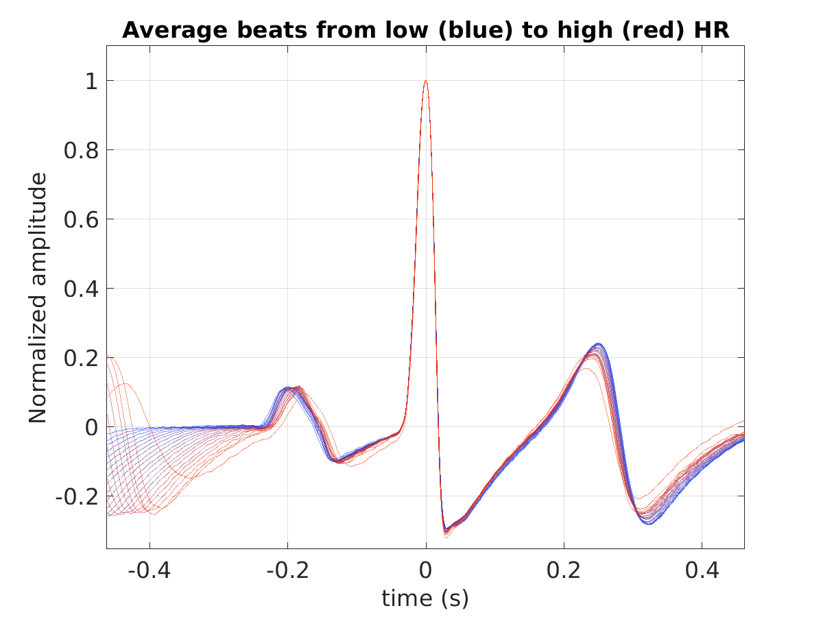 S003_ecg_avg_beats_hr_binned