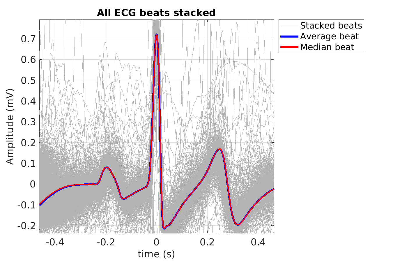 S003_ecg_beats_stacked