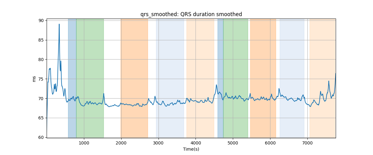 qrs_smoothed: QRS duration smoothed