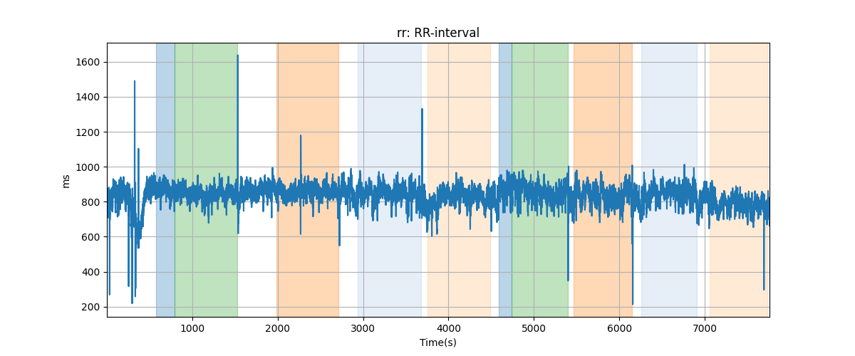 rr: RR-interval