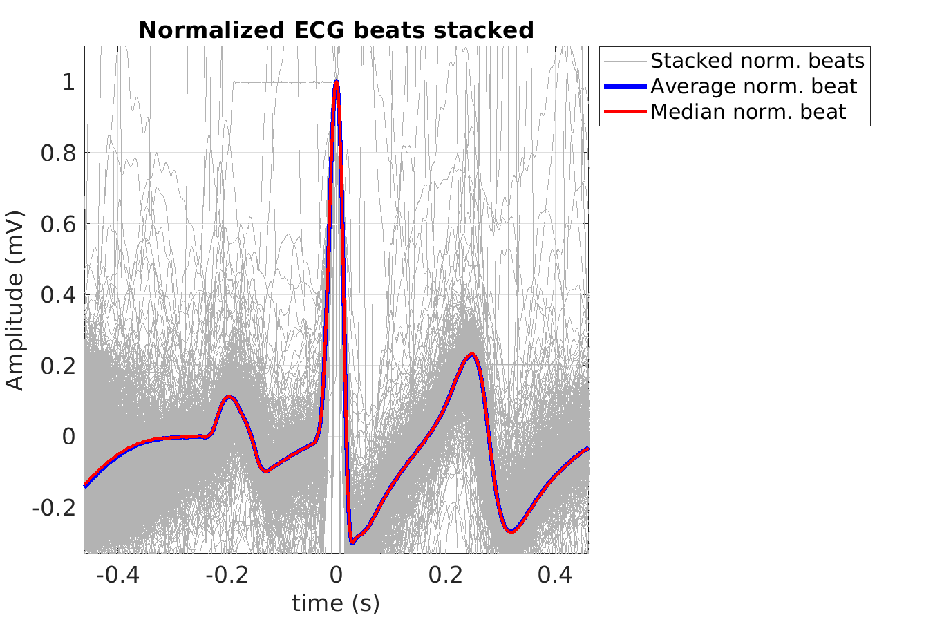 S003_ecg_norm_beats_stacked