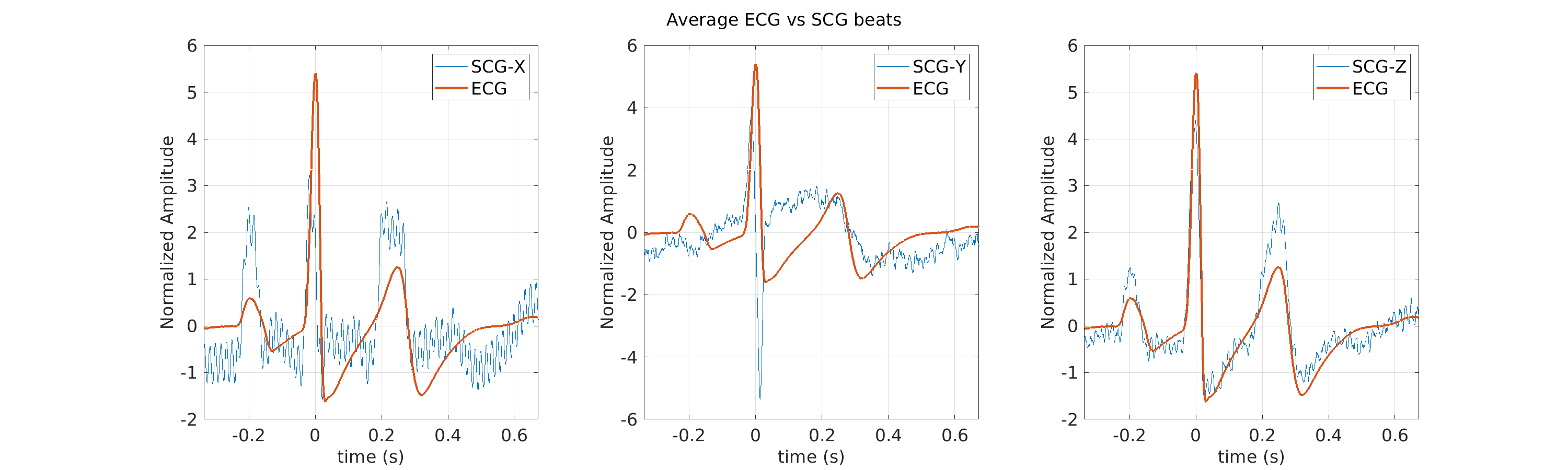 S003_scg_avg_ecg_scg