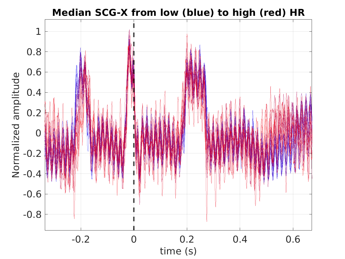 S003_scg_med_scgx_hr_binned_norm