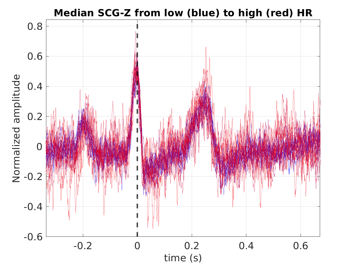 S003_scg_med_scgz_hr_binned_norm