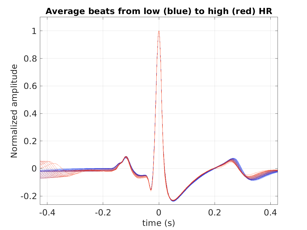 S008_ecg_avg_beats_hr_binned