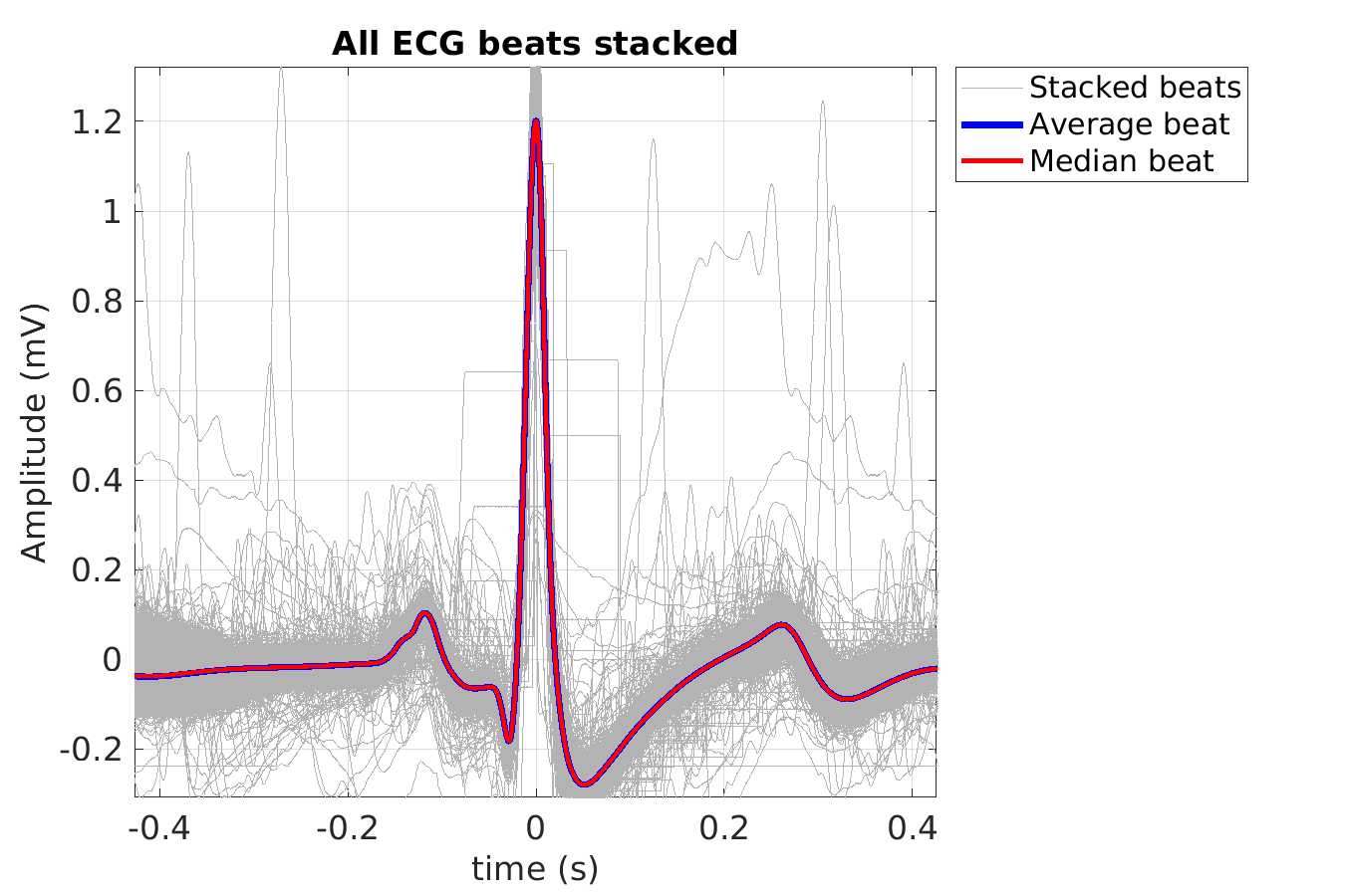 S008_ecg_beats_stacked