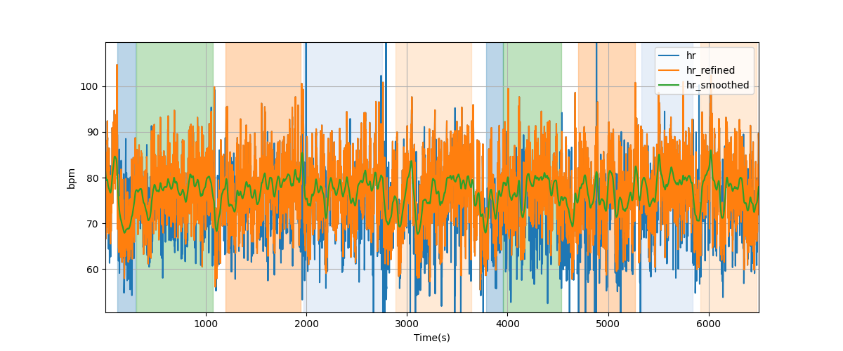 Heart rate - Overlay