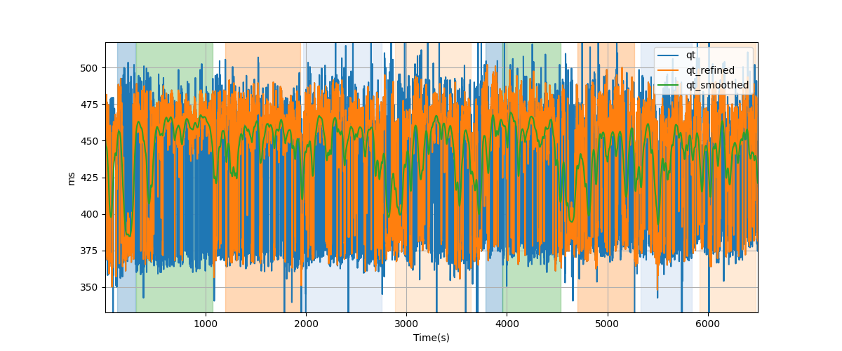 QT intervals - Overlay