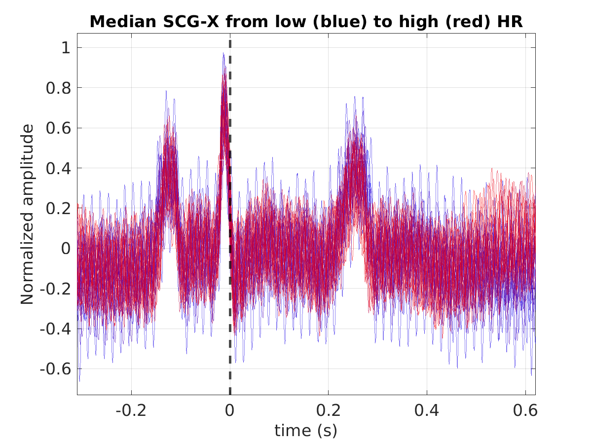 S008_scg_med_scgx_hr_binned_norm