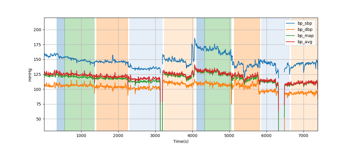 Subject S010 blood pressure data processing summary - Overlay