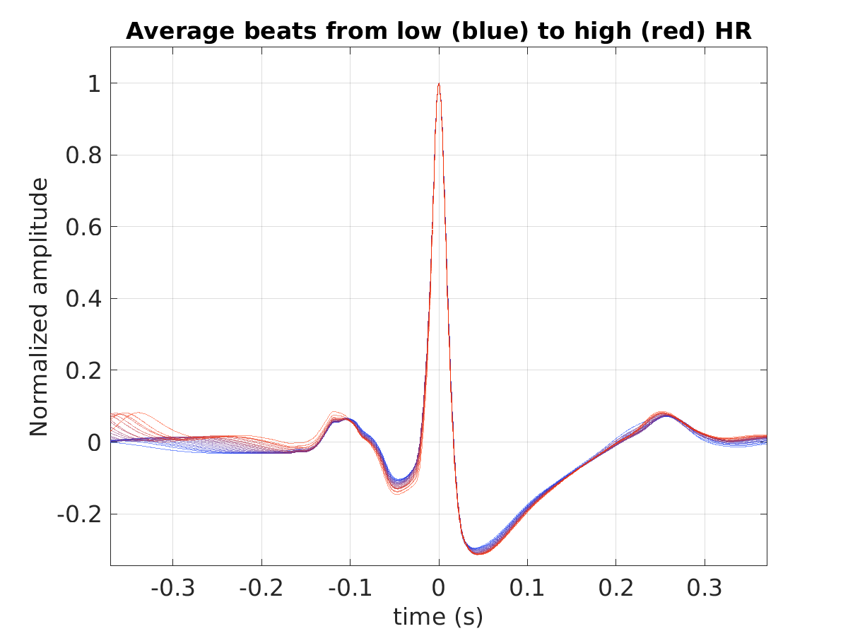 S010_ecg_avg_beats_hr_binned