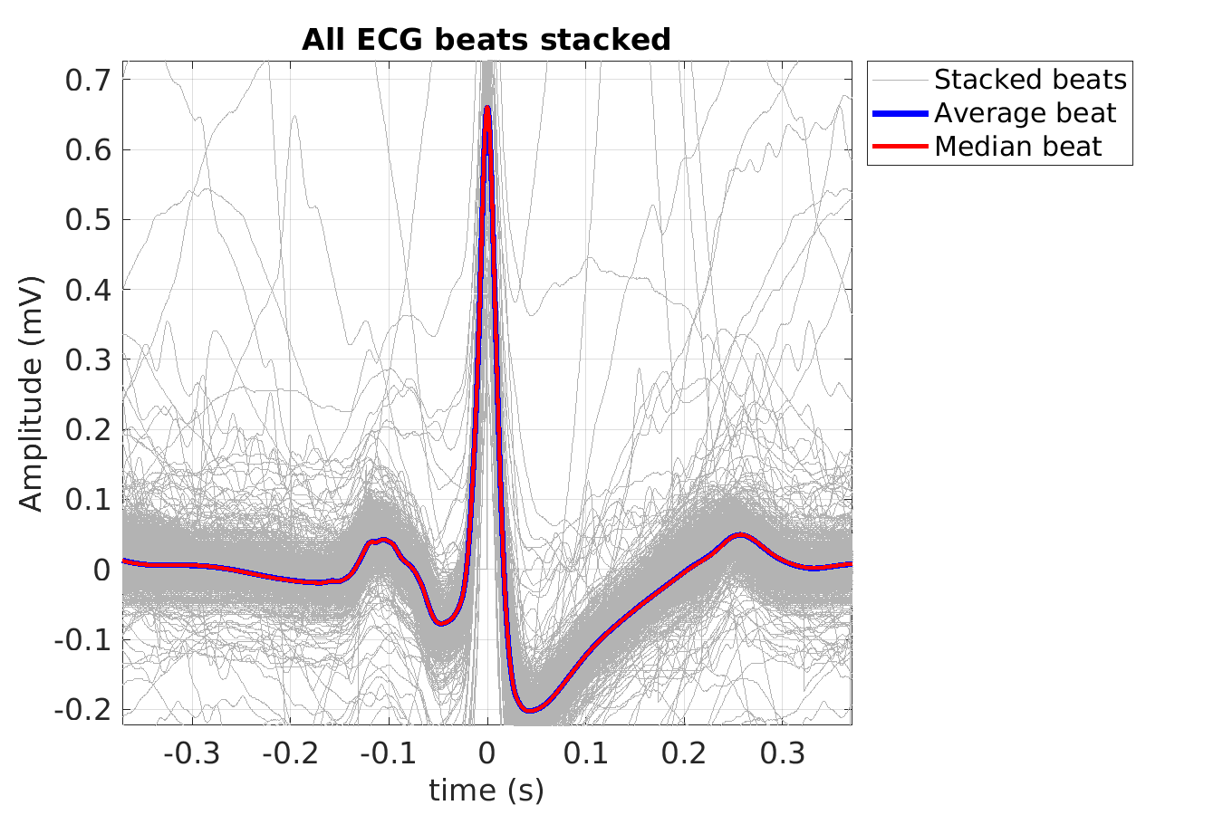 S010_ecg_beats_stacked