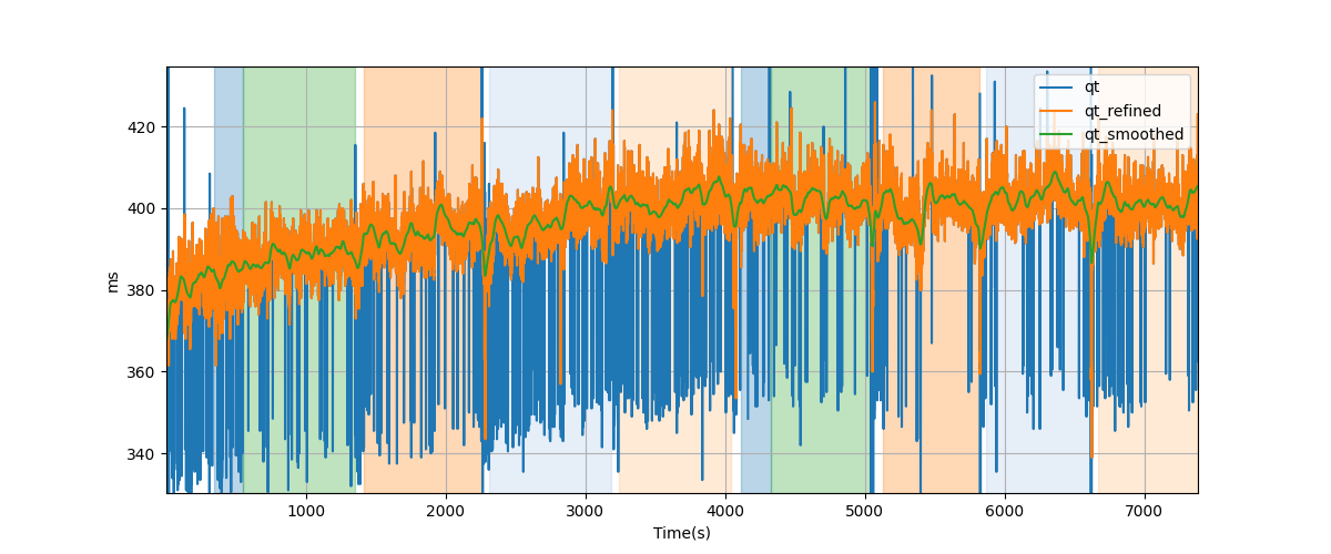 QT intervals - Overlay