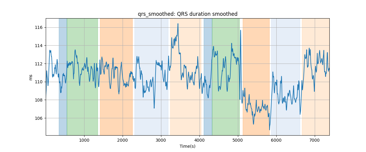 qrs_smoothed: QRS duration smoothed