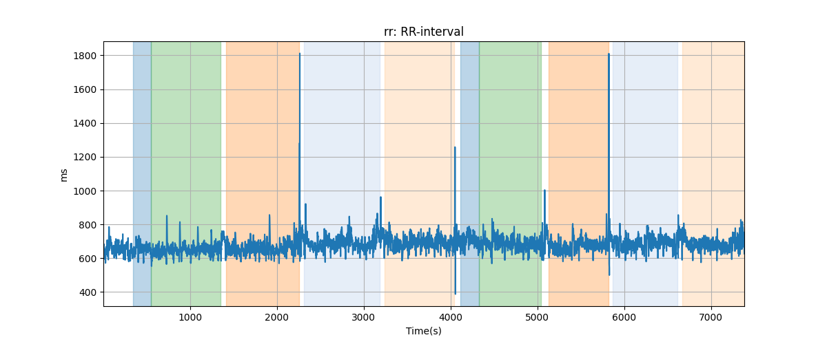 rr: RR-interval