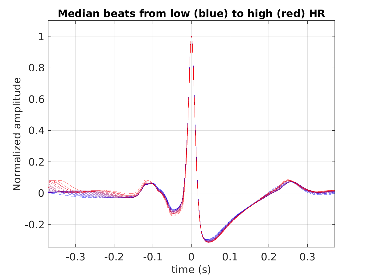 S010_ecg_med_beats_hr_binned