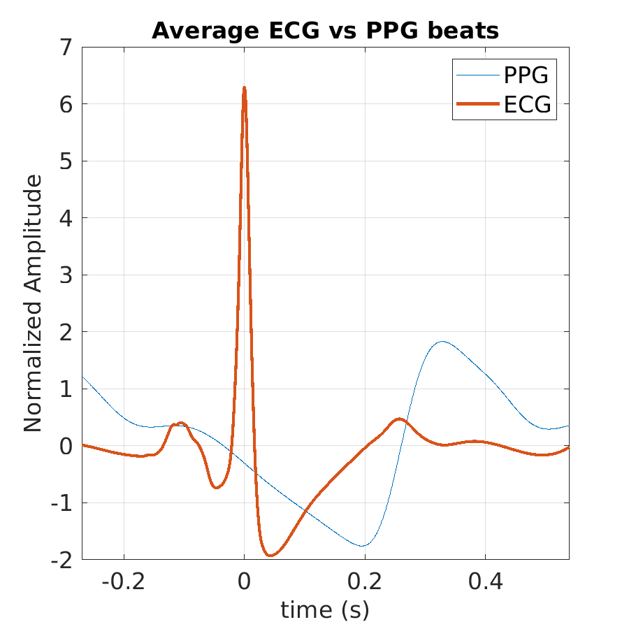 S010_ppg_avg_ecg_ppg