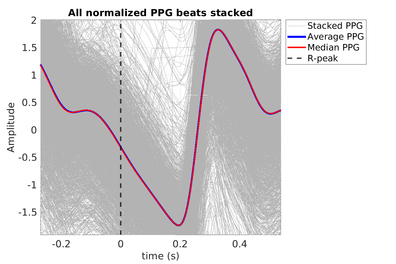 S010_ppg_ppg_stacked_norm