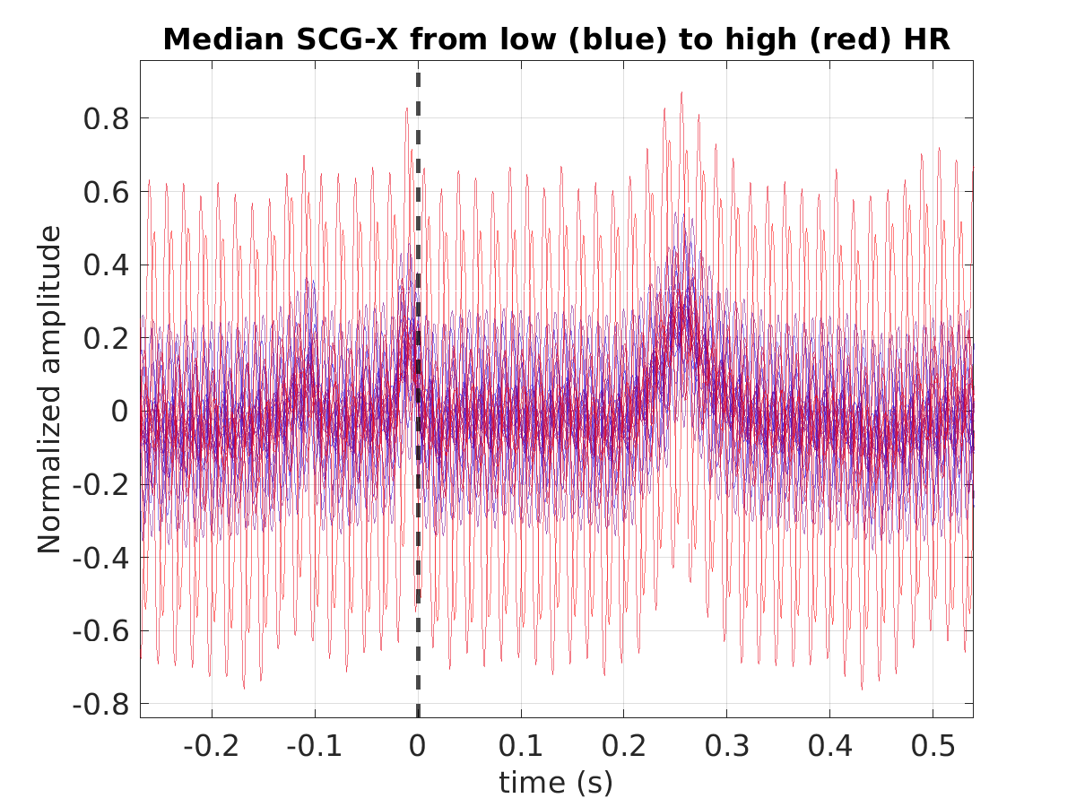 S010_scg_med_scgx_hr_binned_norm