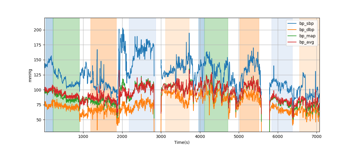 Subject S011 blood pressure data processing summary - Overlay