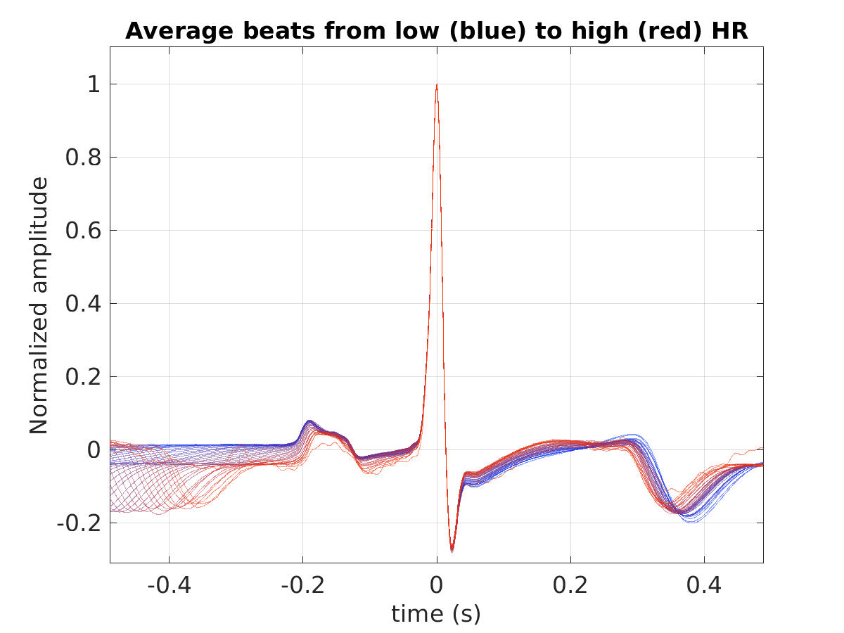 S011_ecg_avg_beats_hr_binned