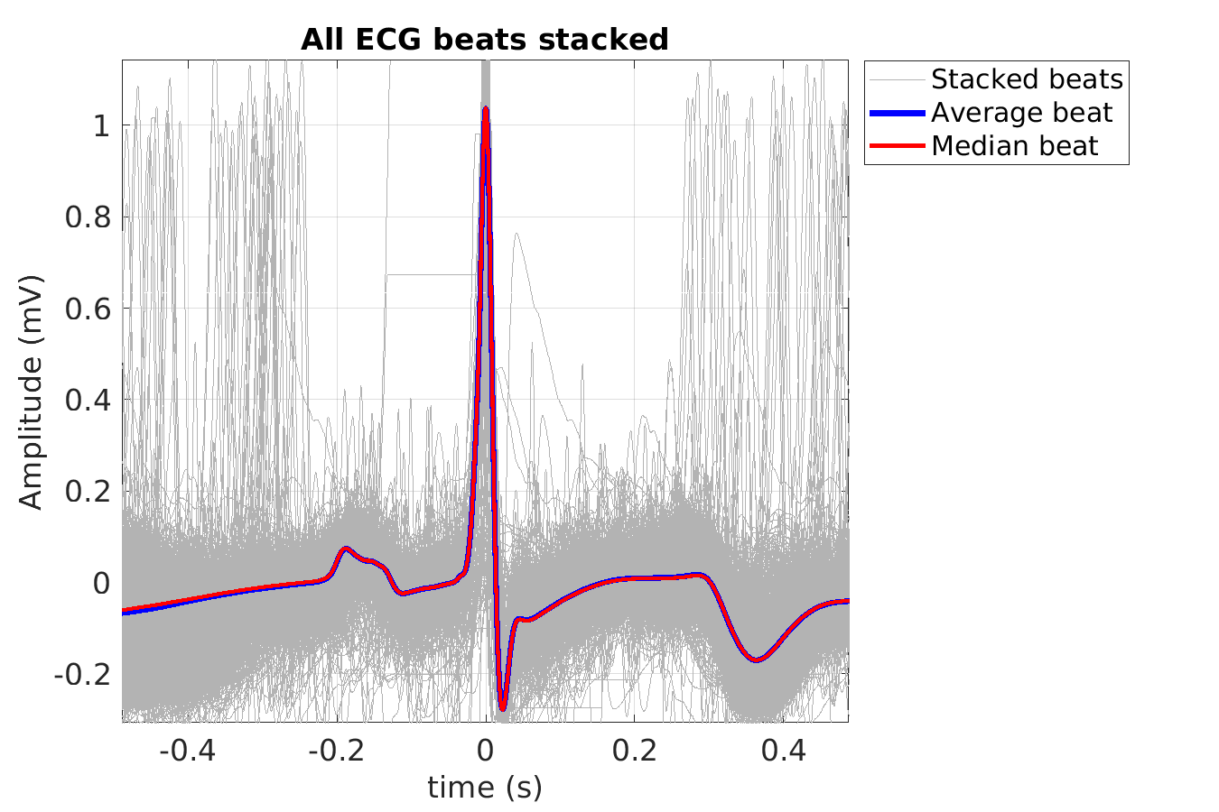 S011_ecg_beats_stacked