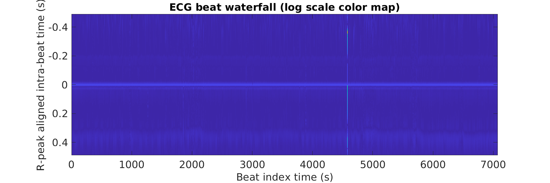 S011_ecg_beats_waterfall_logscale