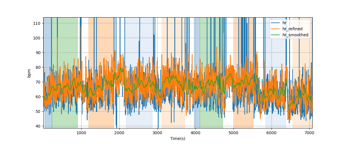 Heart rate - Overlay