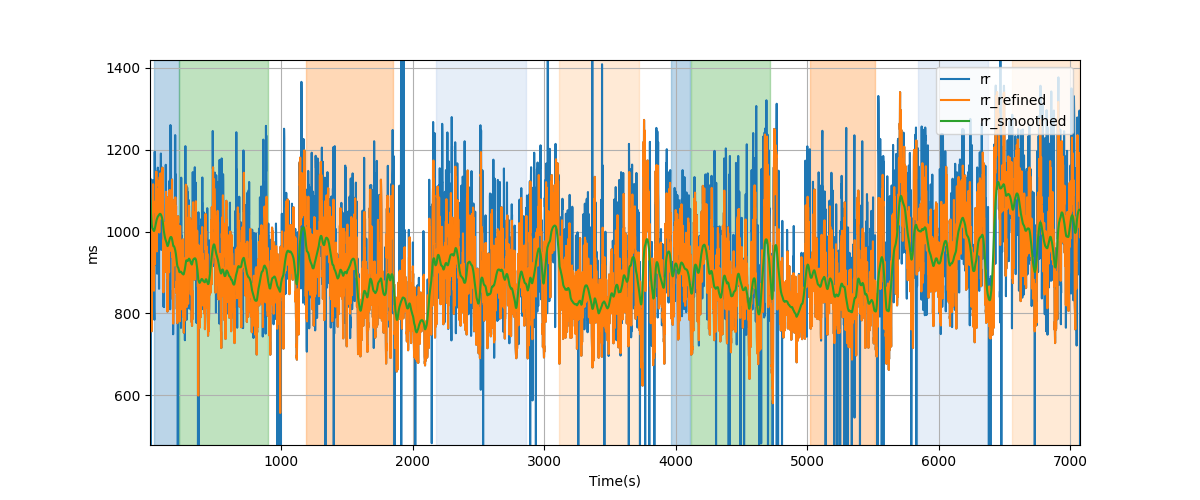 RR intervals - Overlay