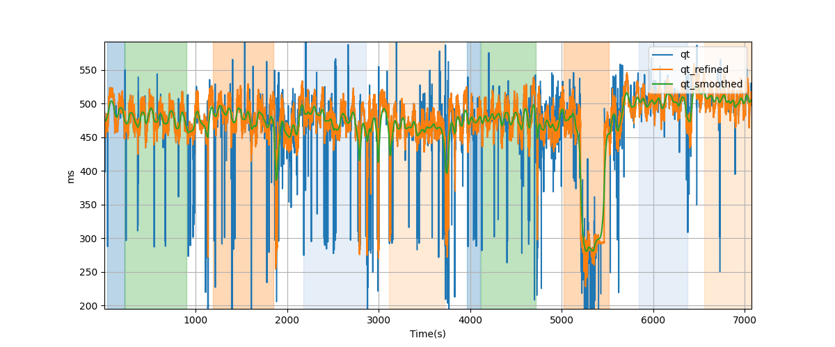 QT intervals - Overlay