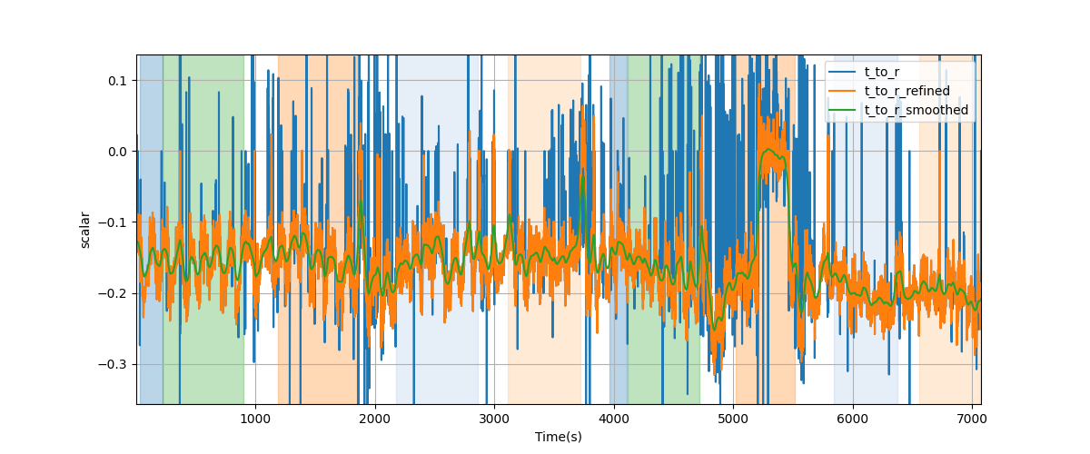 T/R wave ratio - Overlay