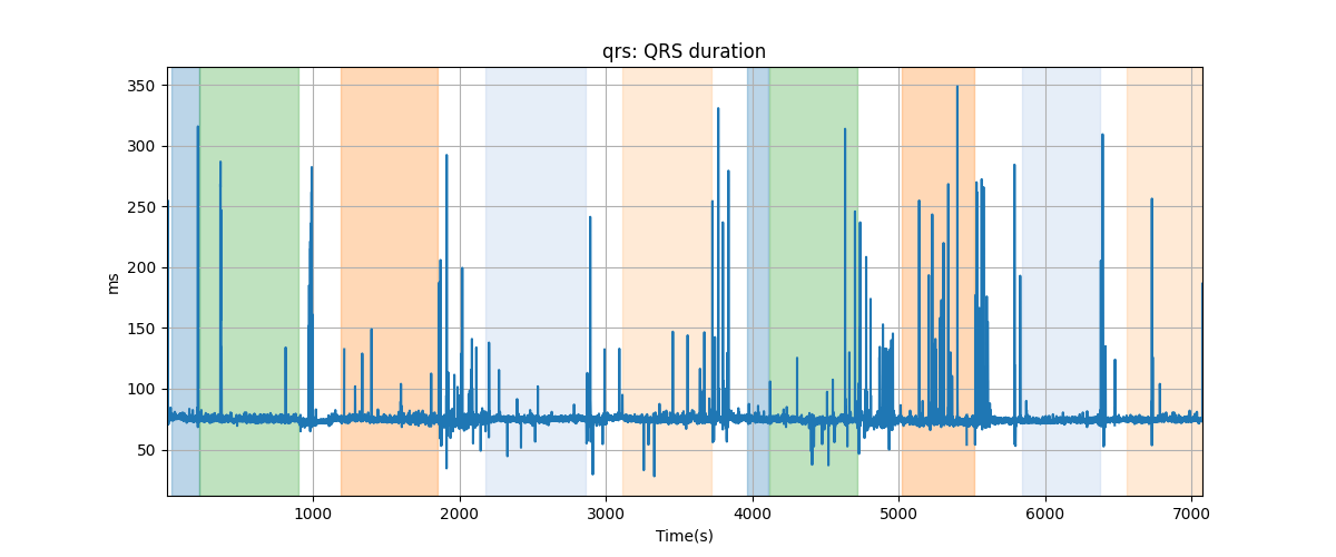 qrs: QRS duration