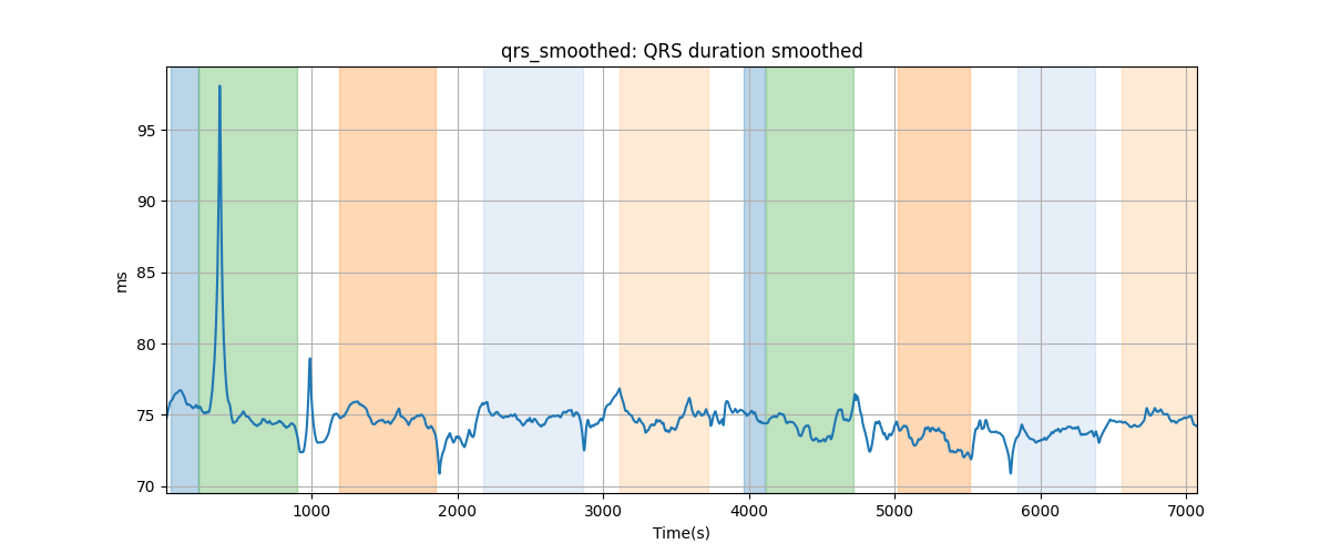 qrs_smoothed: QRS duration smoothed