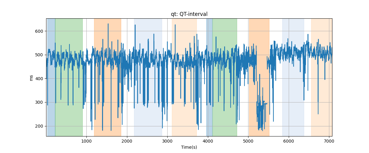 qt: QT-interval