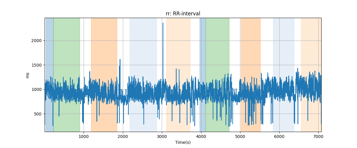 rr: RR-interval