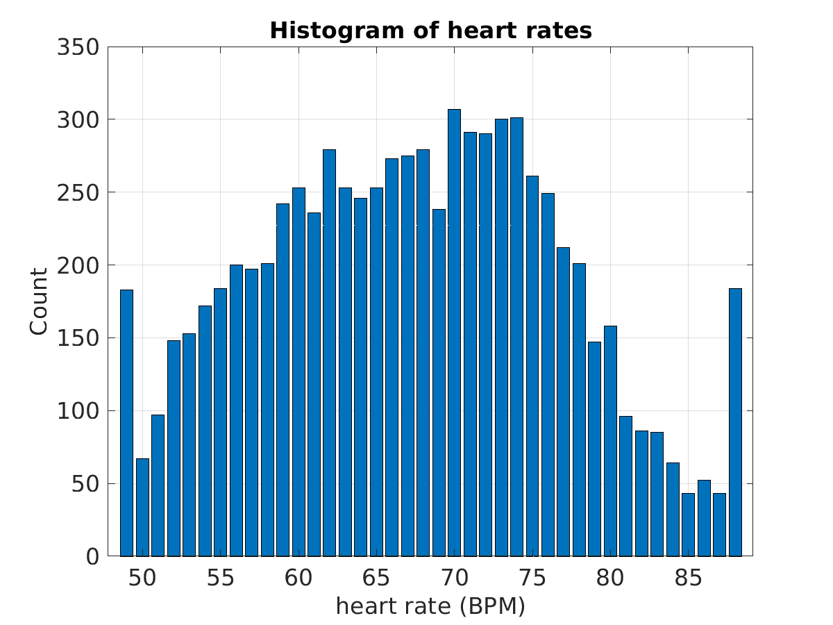 S011_ecg_hr_hist