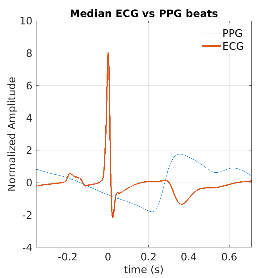 S011_ppg_med_ecg_ppg