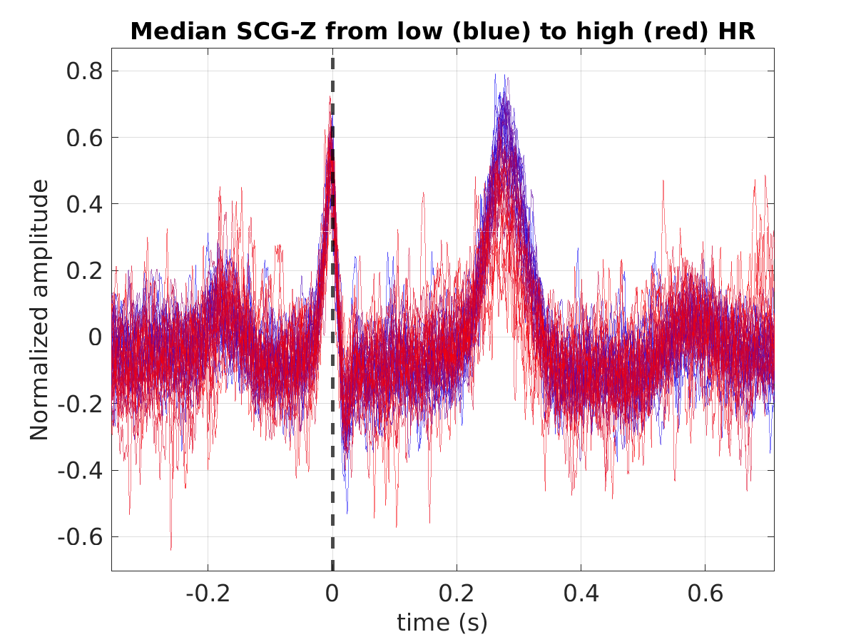 S011_scg_med_scgz_hr_binned_norm