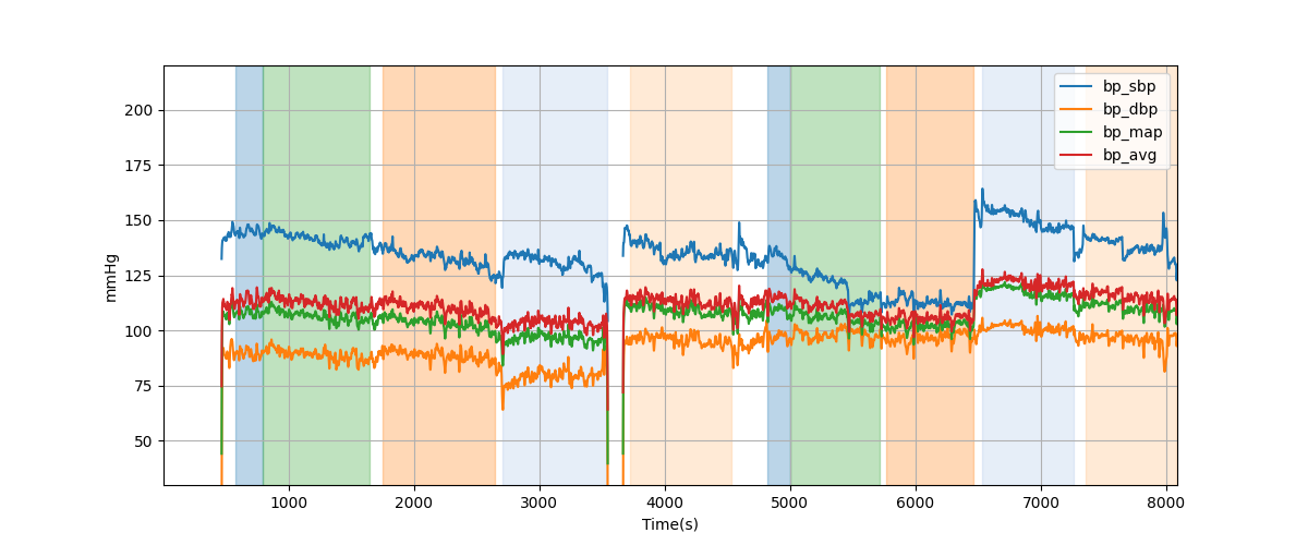 Subject S012 blood pressure data processing summary - Overlay