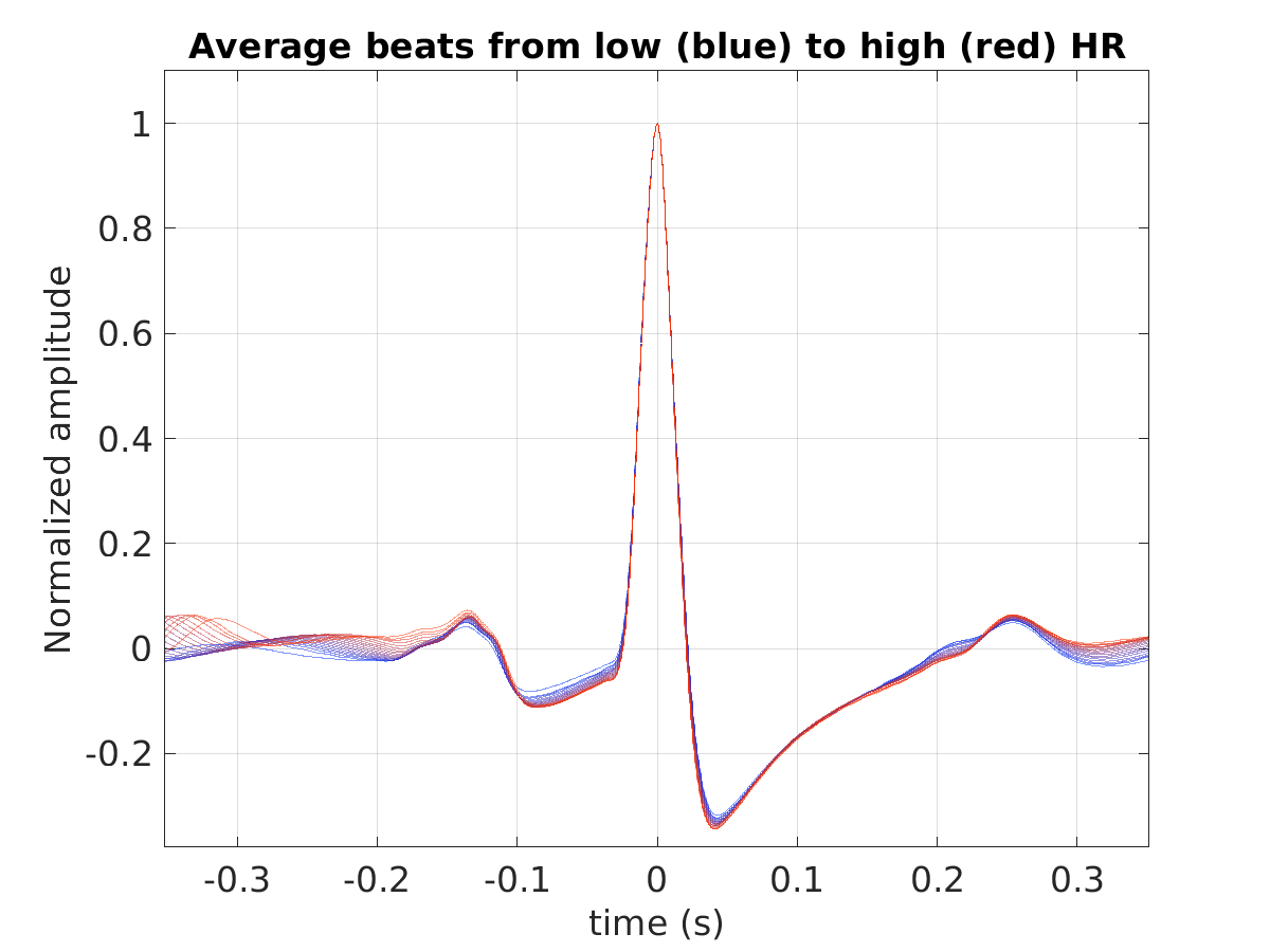 S012_ecg_avg_beats_hr_binned